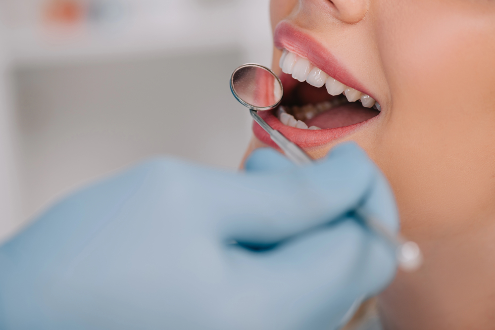 ultimate guide to maintaining whitening results
